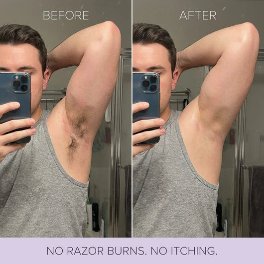 Alivmi Hair Removal Mousse