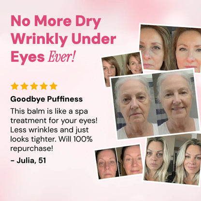 ✨LAST DAY BUY 1 GET 1 FREE✨Revive Tired Eyes – Hydrating & Anti-Wrinkle Eye Balm