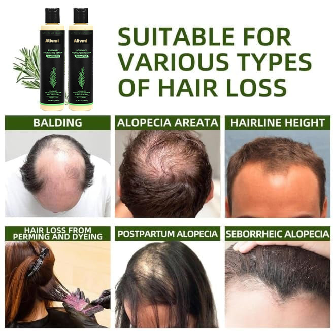 🔥LAST DAY 50% OFF - 🌿Alivmi Organic Rosemary Hair Growth Shampoo
