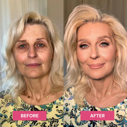 ✨LAST DAY BUY 1 GET 1 FREE✨Revive Tired Eyes – Hydrating & Anti-Wrinkle Eye Balm