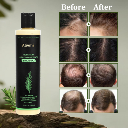 🔥LAST DAY 50% OFF - 🌿Alivmi Organic Rosemary Hair Growth Shampoo
