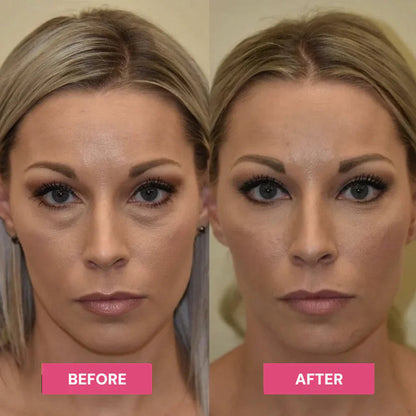 ✨LAST DAY BUY 1 GET 1 FREE✨Revive Tired Eyes – Hydrating & Anti-Wrinkle Eye Balm