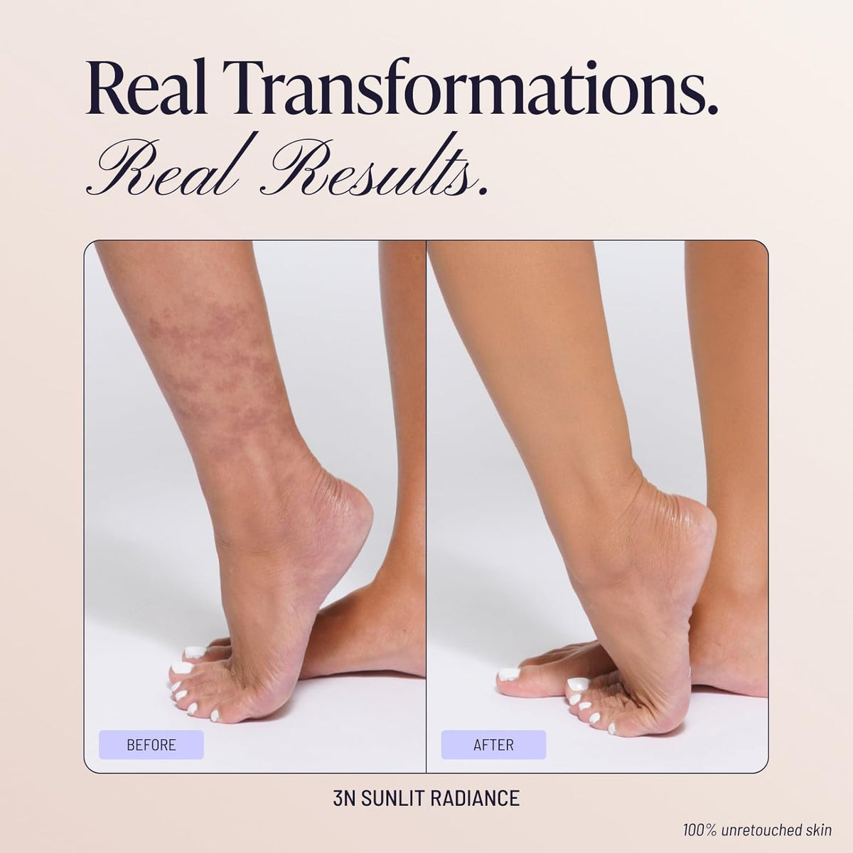 Alivmi™ Flawless Body Coverage Perfector