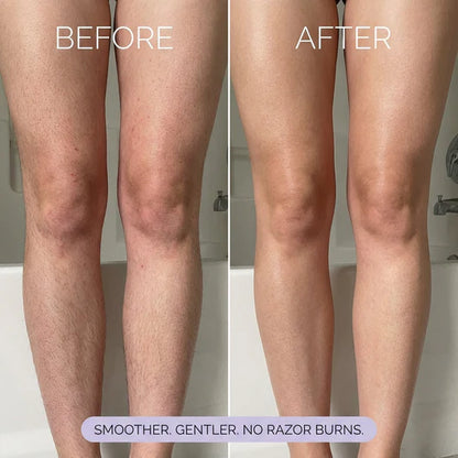 Alivmi Hair Removal Mousse