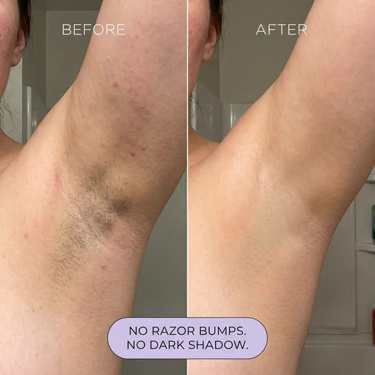 Alivmi Hair Removal Mousse