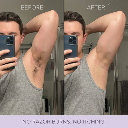 Alivmi Hair Removal Mousse